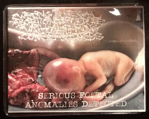 Wrong Illegal Abortion Procedure With Alarming Consequences : Serious Foetal Anomalies Detected